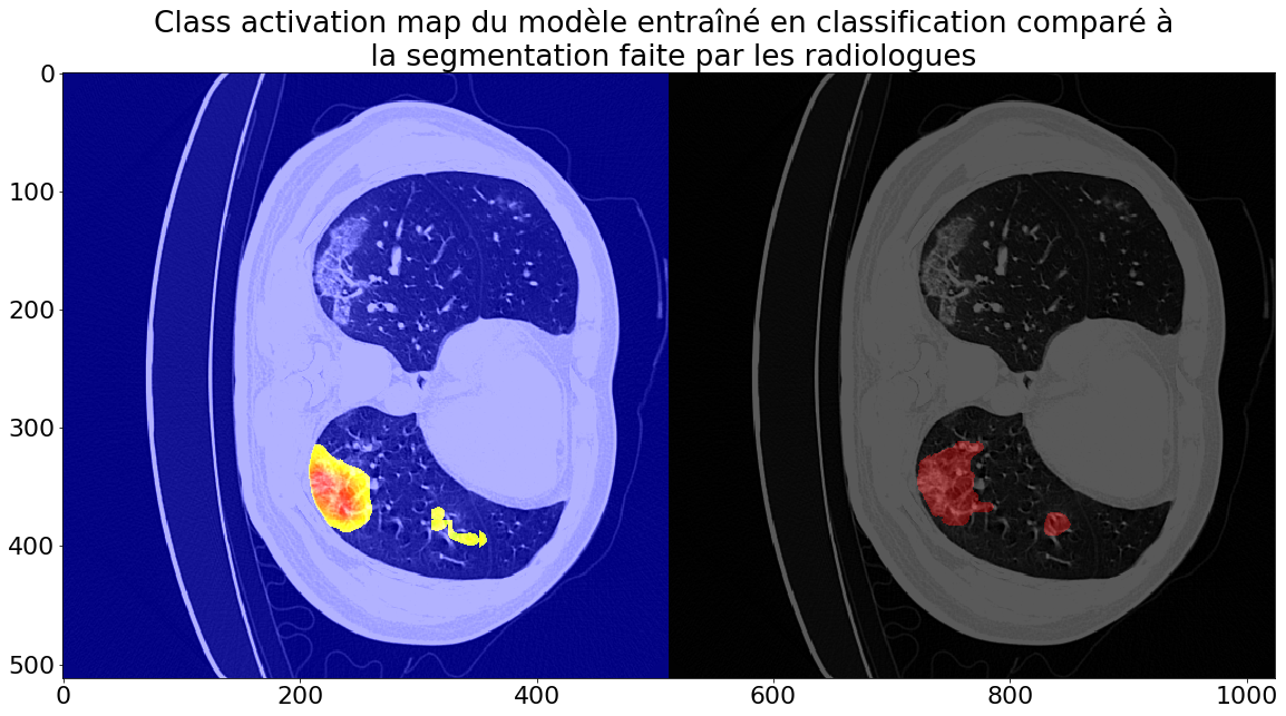 COVID-19 CT segmentation